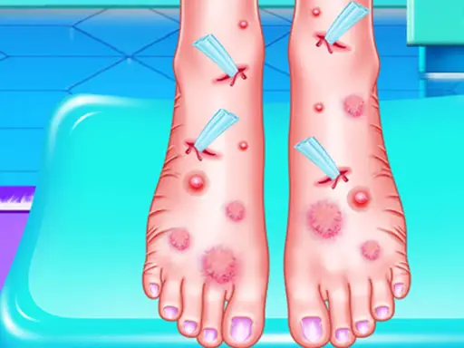 Emma Foot Treatment - Jeu de soin des pieds en ligne gratuit