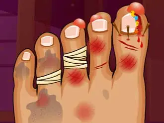 Monster Foot Doctor - Mädchen Spiel zum Pflegen & Heilen