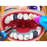 My Dream Dentist - Juego de Dentista Gratis para Jugar en Línea